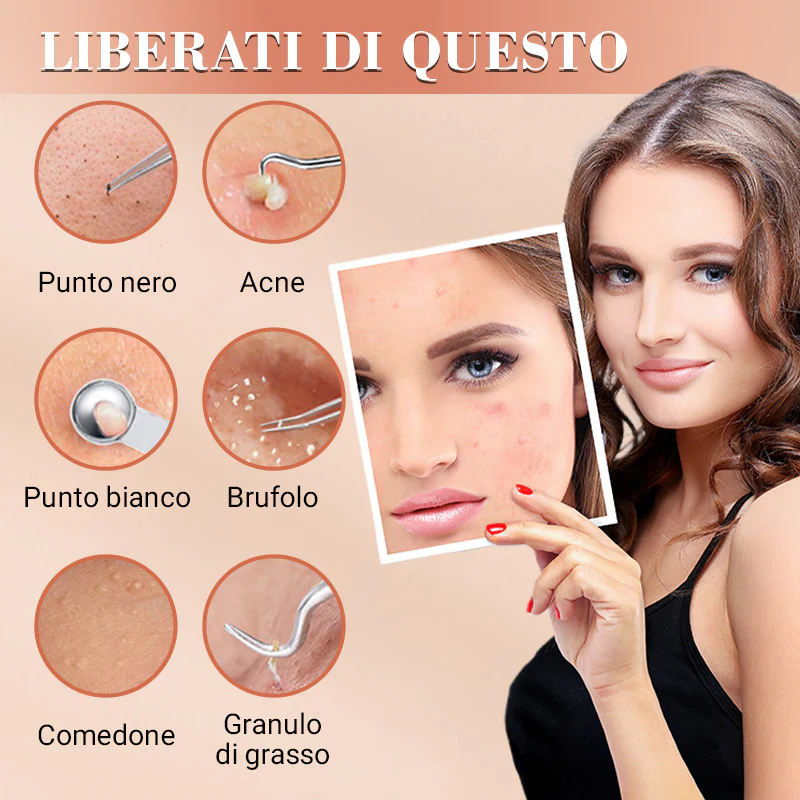 💓58% DI SCONTO💥Kit Strumento Rimuovi Punti Neri e Estraente per Brufoli - Image 2