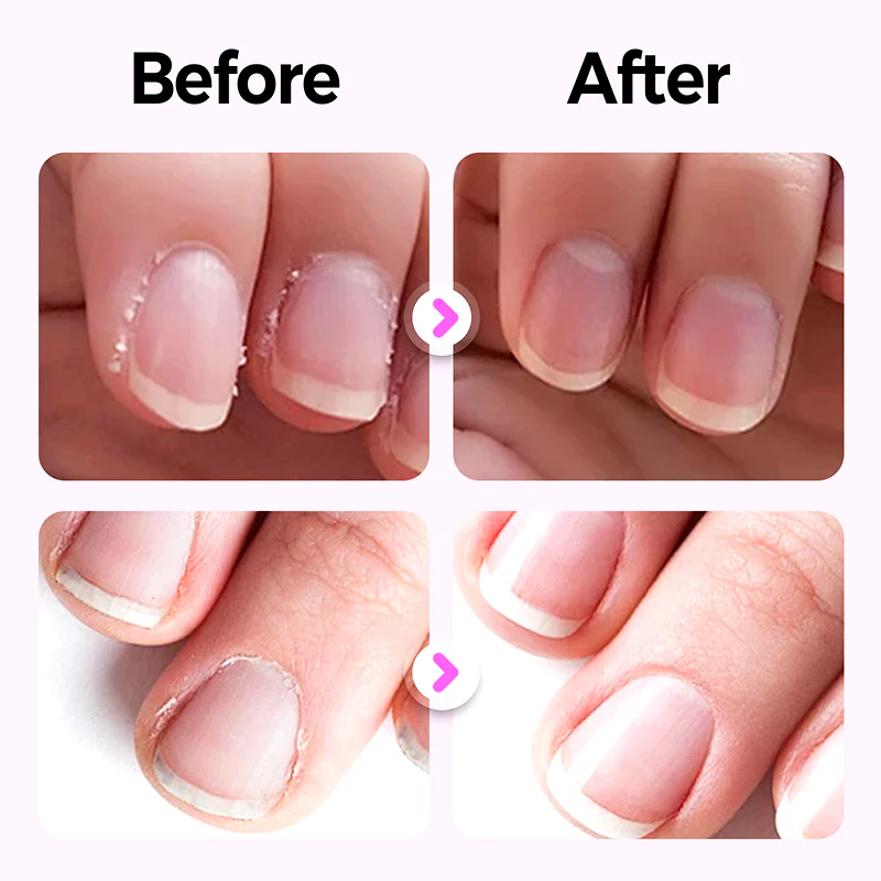 🌟ACQUISTA 1 E RICEVI 1 GRATIS🌟Nuova penna per la cura delle unghie 3 in 1 ag - Image 2