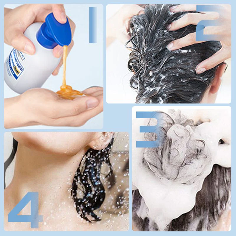 Shampoo antiforfora al bisolfuro di selenio - Image 7