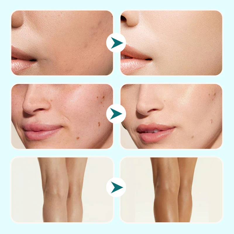 🔥 Vendita calda 49% di sconto💝 Correttore in Crema Impermeabile Idratante per Donne - Image 4